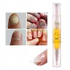 Fityle Fungal Nail Treatment Toe Fungus Removal Anti Infection Liquid Pen
