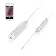 Otoscope, Upgraded 4mm Ultra-Thin Ear Endoscope, 1.0 Megapixels HD Ear Video ...