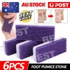 6x Pumice Foot Stone File Exfoliate Rasp Dead Skin Scrub Pedicure Remove Sands