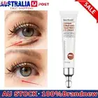 Eye Cream Instant Remove Eye Bags Dark Circles Anti Wrinkle Puffy Eye Remover