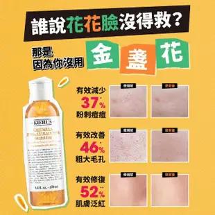 【Kiehl’s 契爾氏】官方直營 藝術家聯名限定 金盞花植物精華化妝水250ml(Kiehl’s)