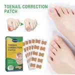 WOOL🔥JAYSUING TOENAIL GROOVE CORRECTION PATCH, INGROWN TOEN