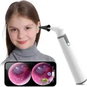 Wireless Otoscope Ear Camera with Dual View, 3.9mm 720PHD WiFi Ear Scope with 6