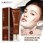AUQUEST Scar Repair Cream Stretch Marks Acne Remove Promote Cell Regeneration...