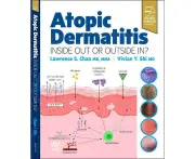 Atopic Dermatitis: Inside Out or Outside In