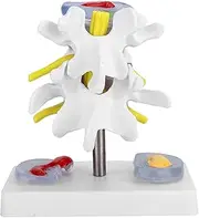 1:1.5 Anatomical Human Disc Herniation Model, Vertebras Degenerative Lumbar Human Spine Model Medical Demonstration Model Human Lumbar Disc Model for Linical Teaching