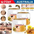 3Pcs Bee Venom Wart and Tag Remover Bee Venom Mole & Wart Treatment Cream 30g AU