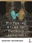 Huda Ezzeddin Mustafa Rajanikant Bha Pictorial Atlas of Thyroid Imagi (Hardback)