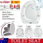 Quick Release O V U Shape White Toilet Seat Cover Soft Close Top Fixing Hinge oz
