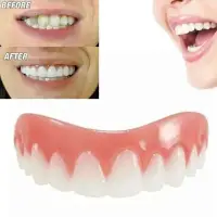 在飛比找蝦皮購物優惠-㊣美國正品㊣ instant smile 現貨可脫卸美容牙套