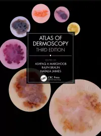 在飛比找博客來優惠-Atlas of Dermoscopy: Third Edi