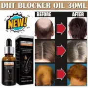 Hair Growth Serum Nourishing Roots Loss DHT Blocker Stop Alopecia! 1 fl oz AUS
