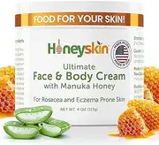 Honeyskin Organics Aloe Vera + Manuka Honey Face and Body Cream for Rosacea Eczema Psoriasis Rashes Itchiness Redness with raw Superfoods 4 oz.