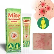 Mite Removal Ointment Anti-Itching Scabies Kill Head Lice Treatment Care Cream