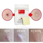 NEW COSRX Acne Pimple Master Patch 6 sheets X 24 Patches Reduce Acne Spots