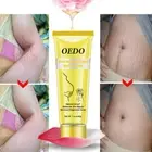 Removal Acne Scar Stretch Marks Stretch Marks Fat Scar Smooth Maternity Cream