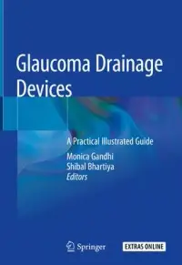 在飛比找博客來優惠-Glaucoma Drainage Devices: A P