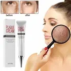 Facial 20G Freckle Whitening Cream Moisturizer for Melanin Age Spots Freckle
