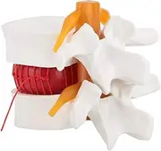 Lumbar Spine Model, 1:1.5 Medical Teaching Instrument, Human Lumbar Disc Herniation Model, Physical Education for Clinical Teaching Surgery Ergonomics