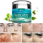 Dark Spot Remover for Face, Hyperpigmentation Treatment, Melasma, Freckle, Sun S
