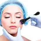 540 Micro 0.25mm Needles Titanium Derma Roller Needle Skin Care Face Acne Scars