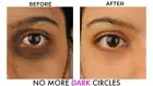 Mamaearth Bye Bye Dark Circles,Under Eye Cream For Dark Circles (Free Shipping)