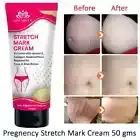 Intimify Stretch Mark Cream for Stretch Mark, Pregnancy Mark (50 gms)