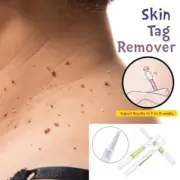 3ml Removal of Warts Liquid From Skin Tags Removing Against Wart Corn Remove CR