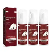 Women Bangs 5% Foam For Thinning Hair And Hair Loss, Hair Regrowth Treatment