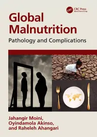 在飛比找博客來優惠-Global Malnutrition: Pathology