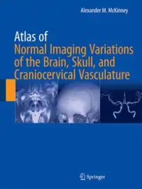 在飛比找博客來優惠-Atlas of Normal Imaging Variat