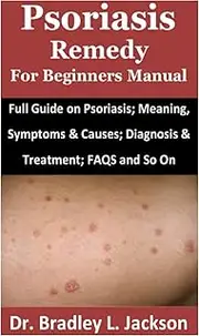 Psoriasis Remedy for Beginners Manual: Full Guide on Psoriasis; Meaning, Symptoms & Causes; Diagnosis & Treatment; FAQS and So On