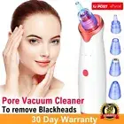 5 in 1 Vacuum Blackhead Remover Derma Suction Pimple Suction With USB Charger