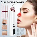 Face Blackhead Remover Vacuum Pore Cleaner with Camera Derma Suction Skin Care