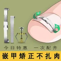 在飛比找蝦皮購物優惠-甲溝炎矯正神器正甲扣嵌甲矯正器腳趾甲往裏長糾正捲甲紮貼片