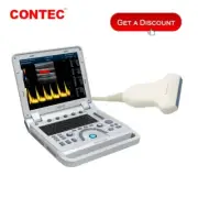 New Color Doppler Ultrasound Scanner Laptop Machine USG Diagnostic Convex+Linear