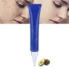 20g Face Freckle Removal Cream Lightening Age Spots Freckles Whitening Facia WAS