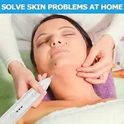 Freckle, Wart, Mole, And Skin Tag Removal Pen - Get Spotless Skin With This Beauty Care Machine