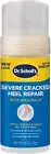 Dr. Scholl’s® Severe Cracked Heel Balm