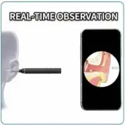 Smart Visual Ear Cleaner Ear Stick Endoscope Earpick Camera Otoscope Ear Cleaner