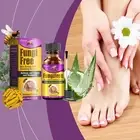 ANTI FUNGAL TREATMENT EXTRA STRENGTH TOE ONYCHOMYCOSIS NAIL FUNGUS TREATMENT NEW