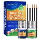Gentle Skin Tag Remover Treatment Safe Wart Acne Removal Body Face Liquid Kit