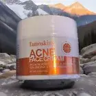 Acne Face Cream, Salicylic Acid Cystic Acne Treatment For Face, Back But Acne...