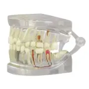 Teeth Jaw CLEAR GPI Anat Model wKey Card LFA #2861 Make Us an Offer!SEE VIDEO