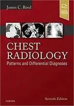 CHEST RADIOLOGY: PATTERNS AND DIFFERENTIAL DIAGNOSES 7/E JAMES 2017 ELSEVIER