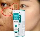 Whitening Freckle Cream Moisturizing Brighten Face Remove Melasma Cream Remove