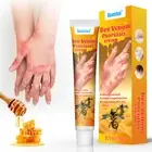 20G Bee Venom Psoriasis Cream For Relieve Dermatitis Psoriasis Itchy Skin
