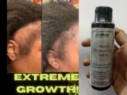 Raw Batana Oil for Hair Growth from Honduras, Dr. Sebi Hair Oil 100ml Fast ship