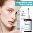 ntensive Renewal Serum with Mandelic Acid Acne Serum GXO