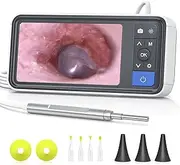 Otoscope Ear Camera with 4.5" IPS Screen, 1920x1080 FHD Smart Visual Ear Wax Removal Tool Camera Kit, 32GB Card Ear Scope Otoscope with Light, Plug & Play at Home Ear Infection Detector
